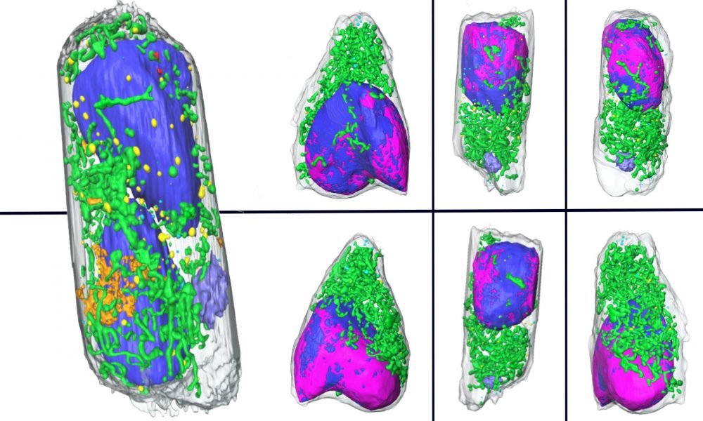 Cells Infected With SARS-CoV-2 Advanced Light Source